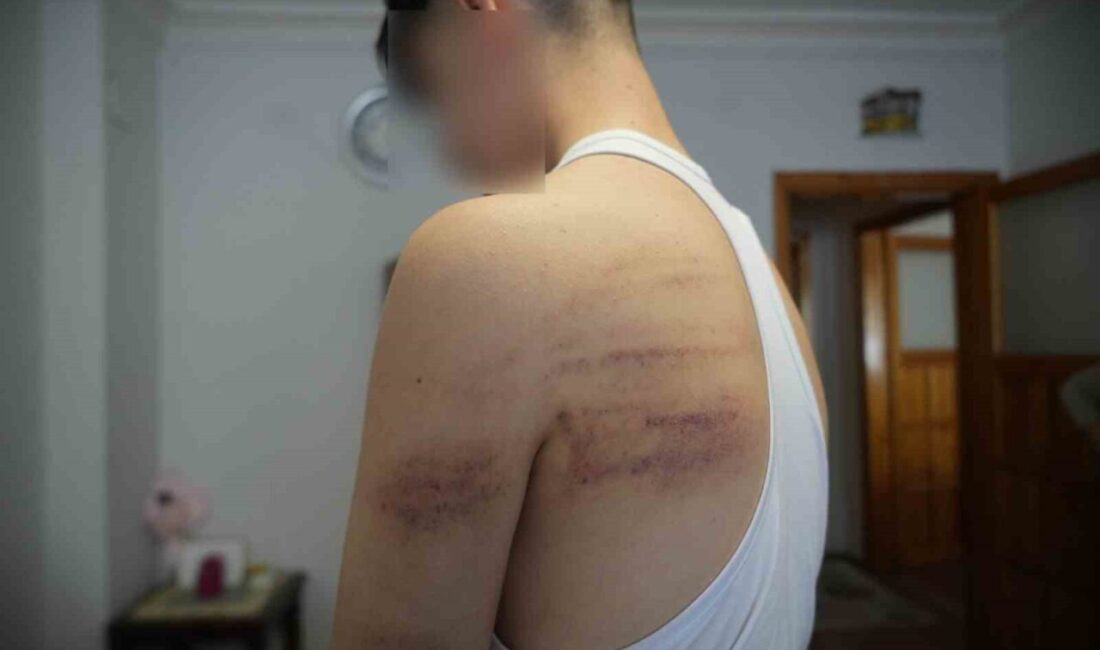 Niğde’de, 15 yaşındaki bir berber çırağını darp ettiği iddiasıyla gözaltına