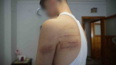 Niğde’de, 15 yaşındaki bir berber çırağını darp ettiği iddiasıyla gözaltına