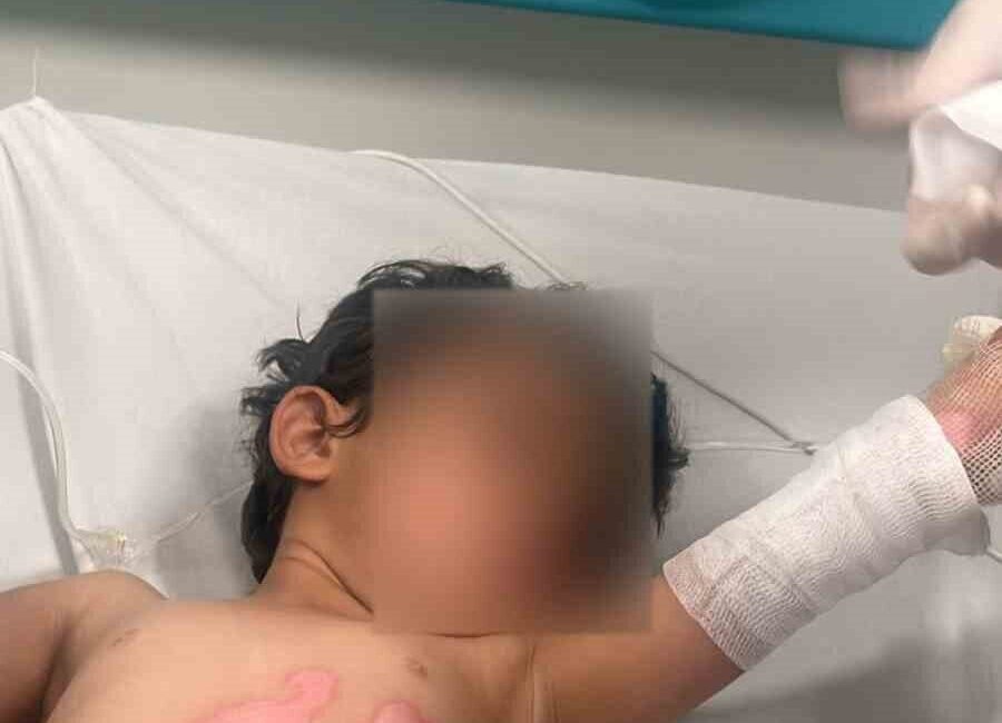 Şırnak’ın Kumçatı beldesinde banyo için su ısıtıldığı esnada kaynar kazan,
